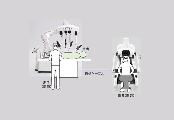 通常のロボット支援手術における手術室内の配置