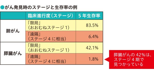 がん発見時のステージと生存率の例